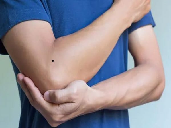 Nốt ruồi ở khuỷu tay trái nói lên điều gì?
