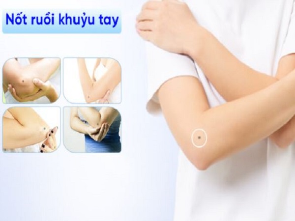 Ý nghĩa chung của nốt ruồi ở khuỷu tay